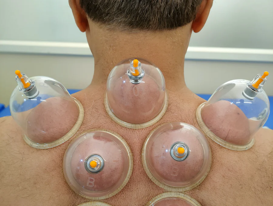Séance de hijama (cupping therapy) à Marrakech dans un cadre professionnel